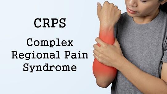 Understanding CRPS with Dr. Smita Gulati