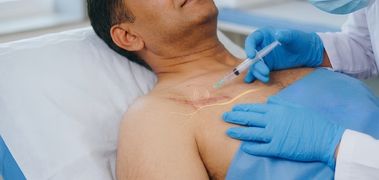 Nerve Block
